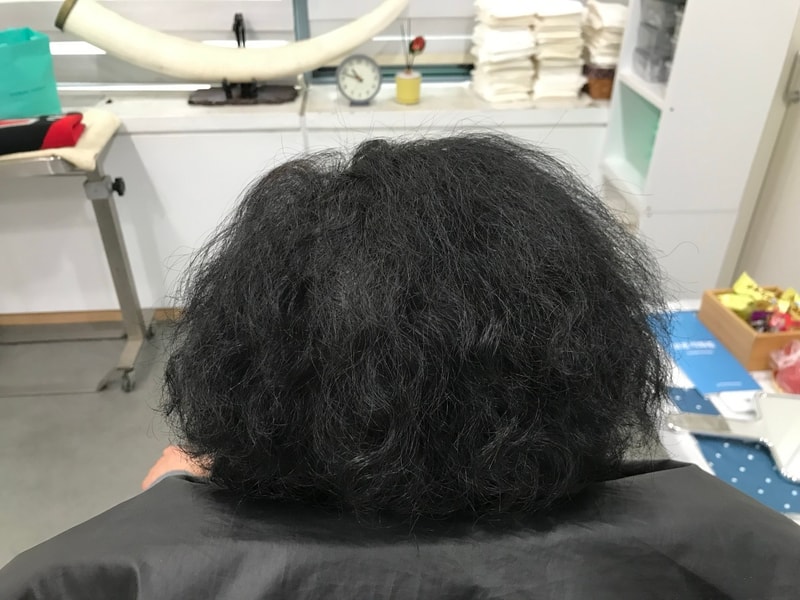 엄마 두피문신 리터치 후기입니다!