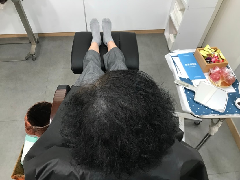 리터치 후