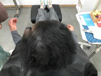 리터치 전