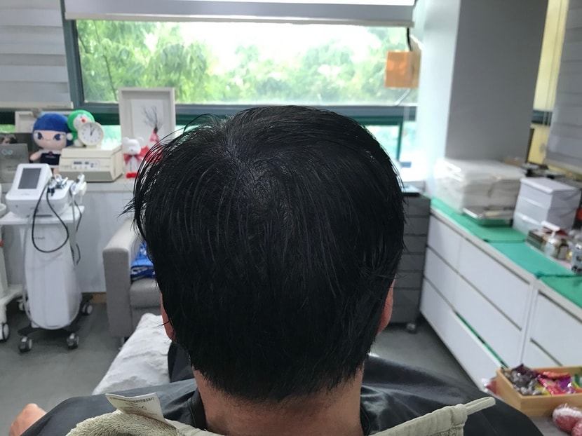 리터치 후