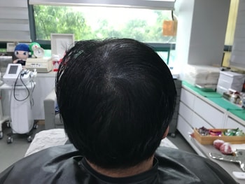 리터치 전