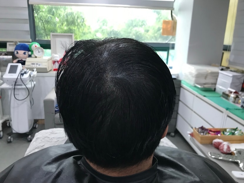 리터치 전