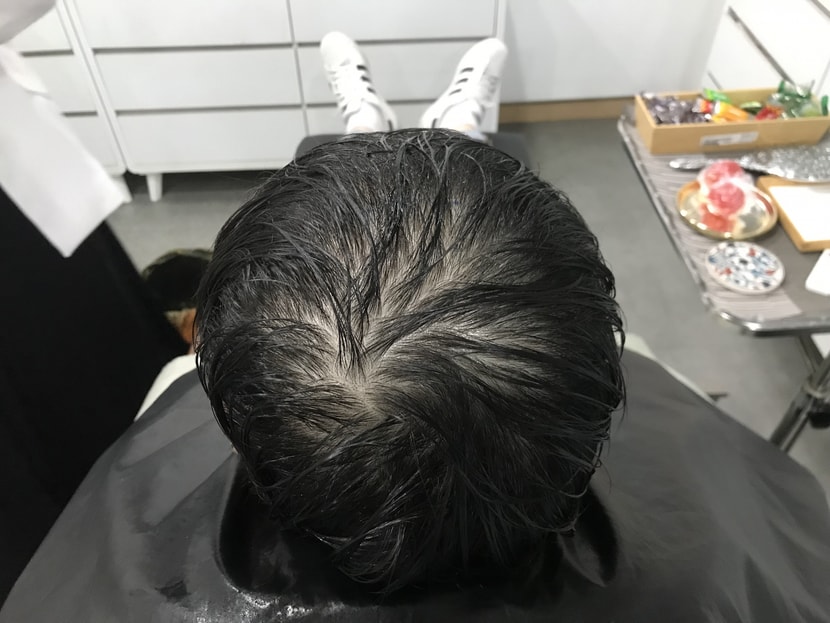 시술 전 젖은머리입니다