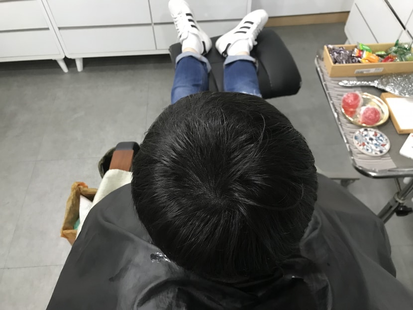 시술 후 마른머리입니다