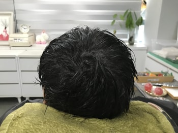 시술 후 젖은머리입니다