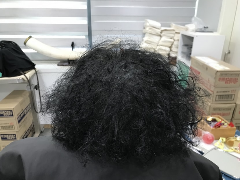 후