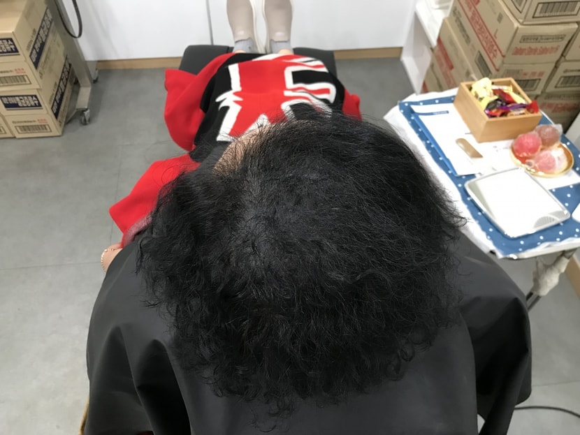 전