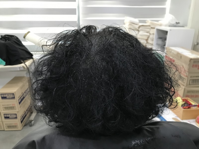 연세미다인 저희 엄마 2차 리터치 후기입니다