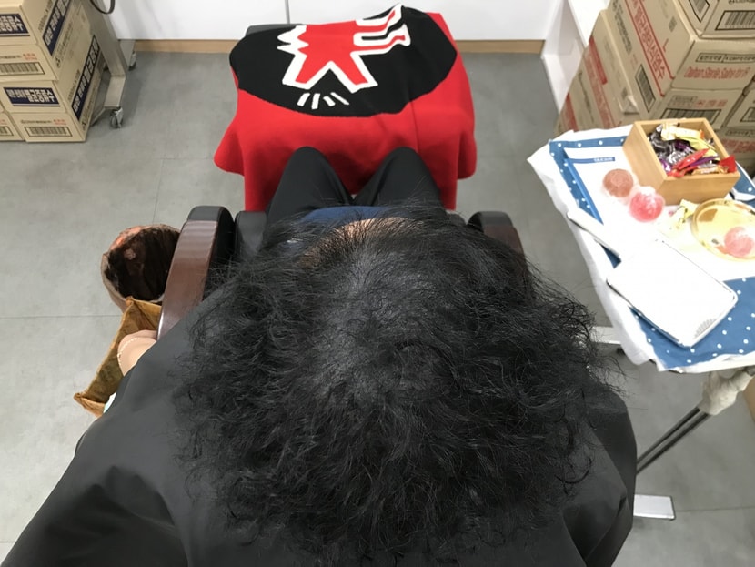 리터치 후