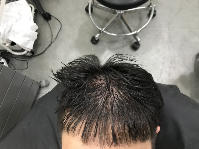 是2张全豆腐的多功能smp后记。