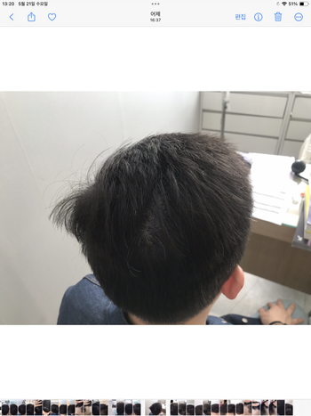 두피문신 7년 후 현재