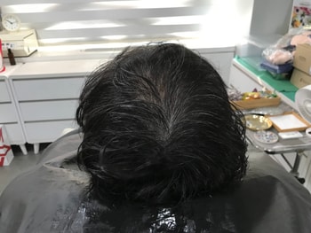 전