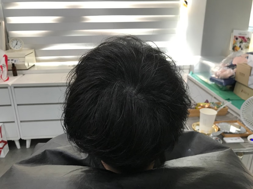 후