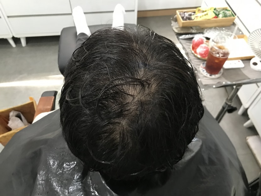 &lt;전&gt;