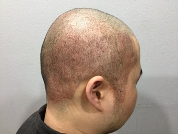 1차(빽빽하게 잘 되었으나 붉은기가 있음)