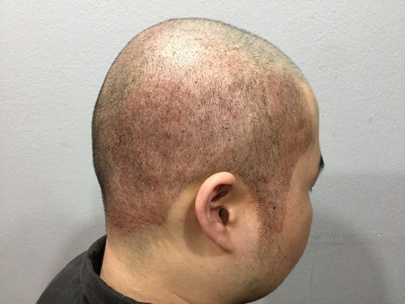 1차(빽빽하게 잘 되었으나 붉은기가 있음)