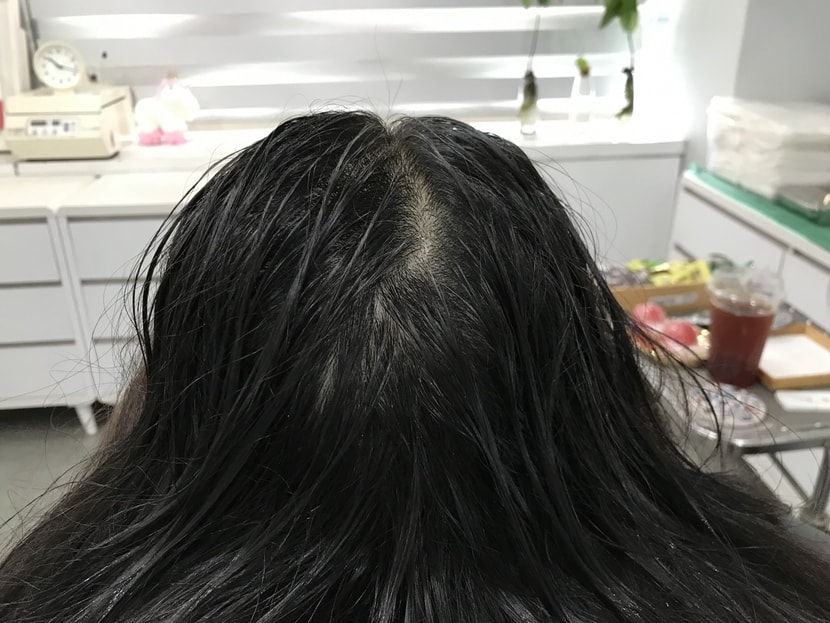 시술전 젖은 상태