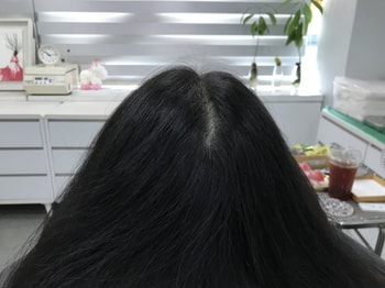 시술전 마른상태
