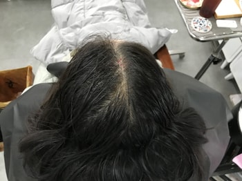 시술전 젖은 상태