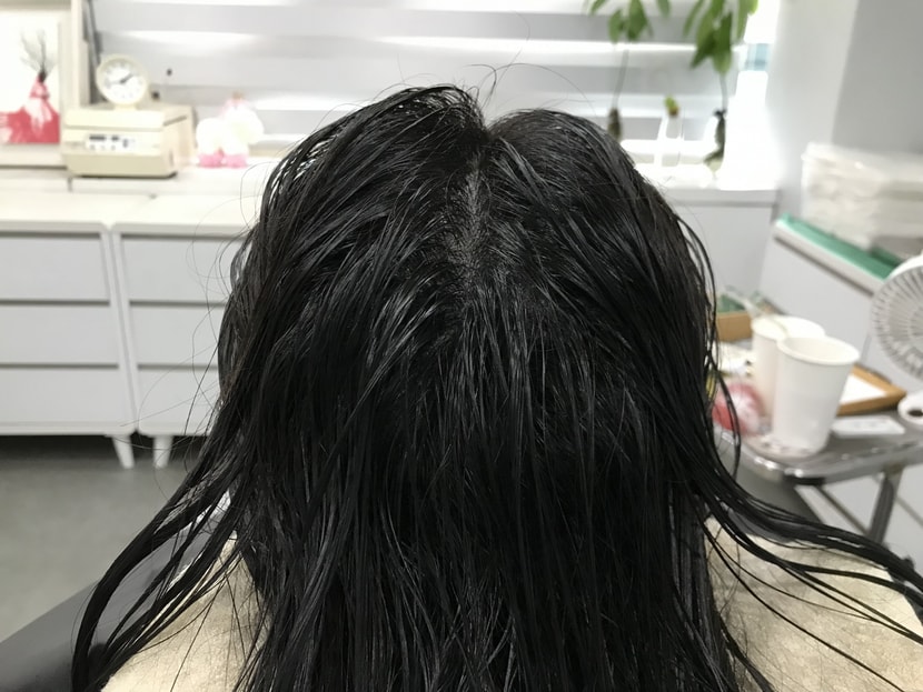 시술후 젖는 상태
