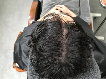 시술 후 젖은상태