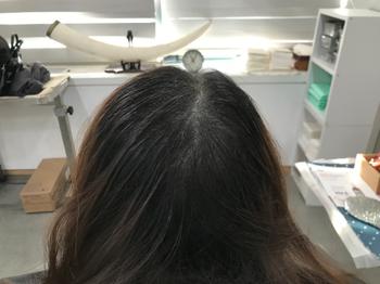 리터치전