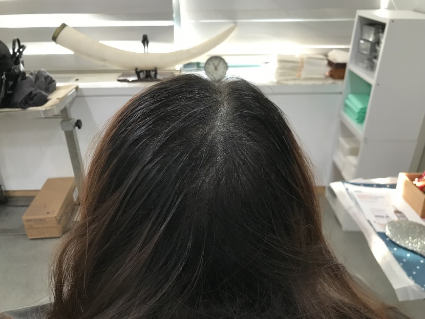 리터치전
