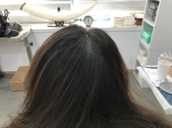 리터치후