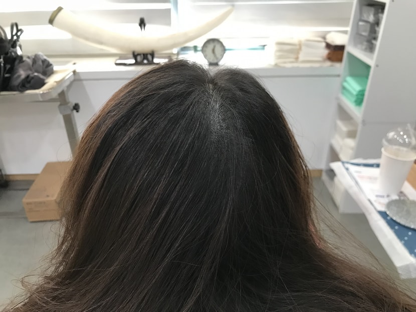 리터치후