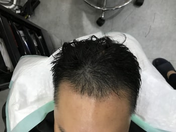 애프터1