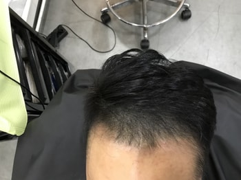 애프터2