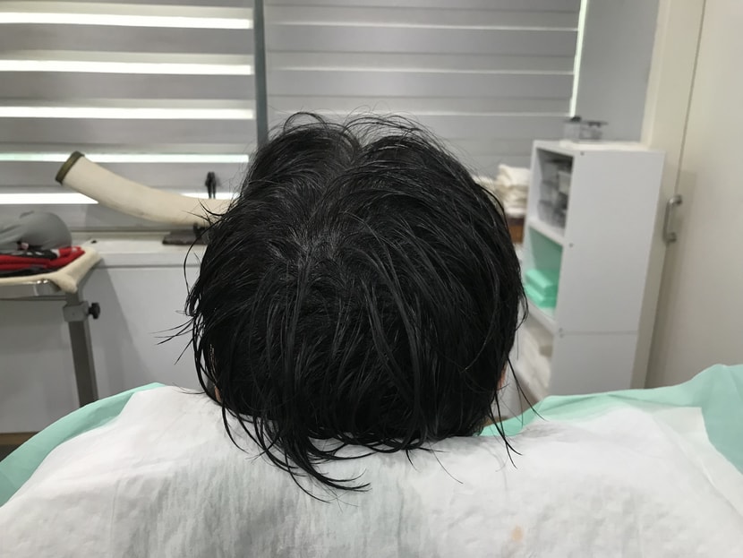 리터치 후, 젖은 모습