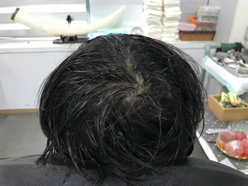 시술전 젖은 상태