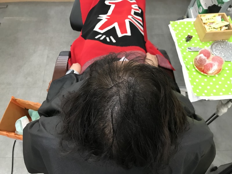 도트그라데이션기법으로 두피문신 한달 후 리터치 받았어요~^^