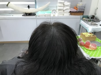 리터치 후