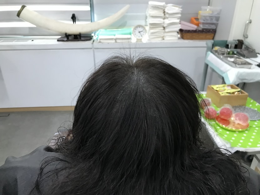 리터치 후