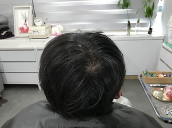 두피문신전
