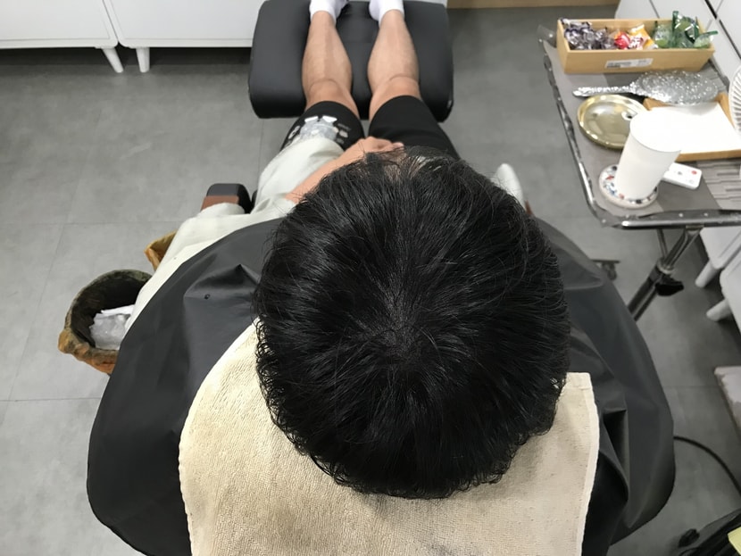 시술후