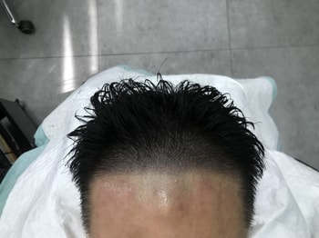 애프터1