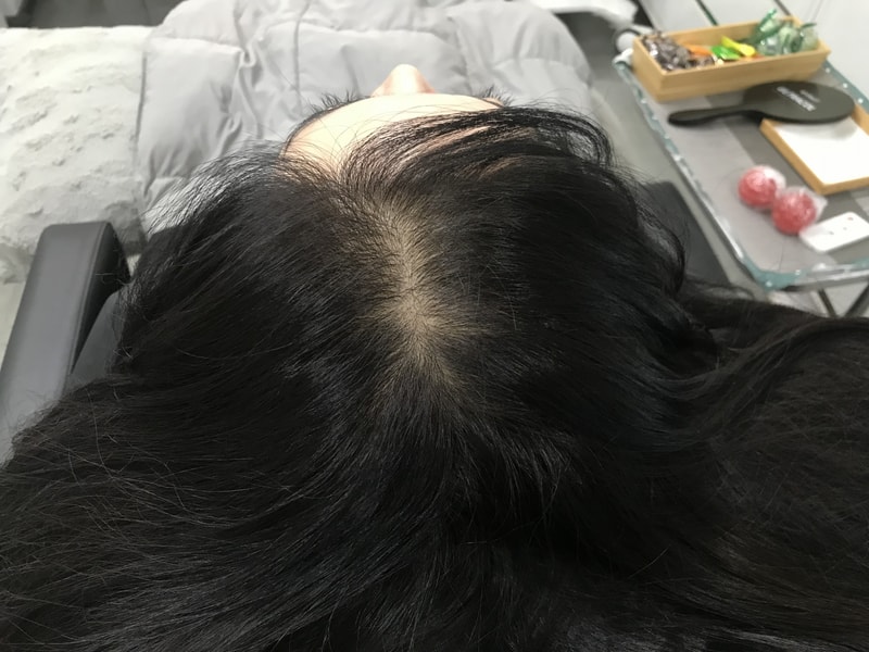 延世美多仁！头皮纹身丰盛满！ 用双脚?????