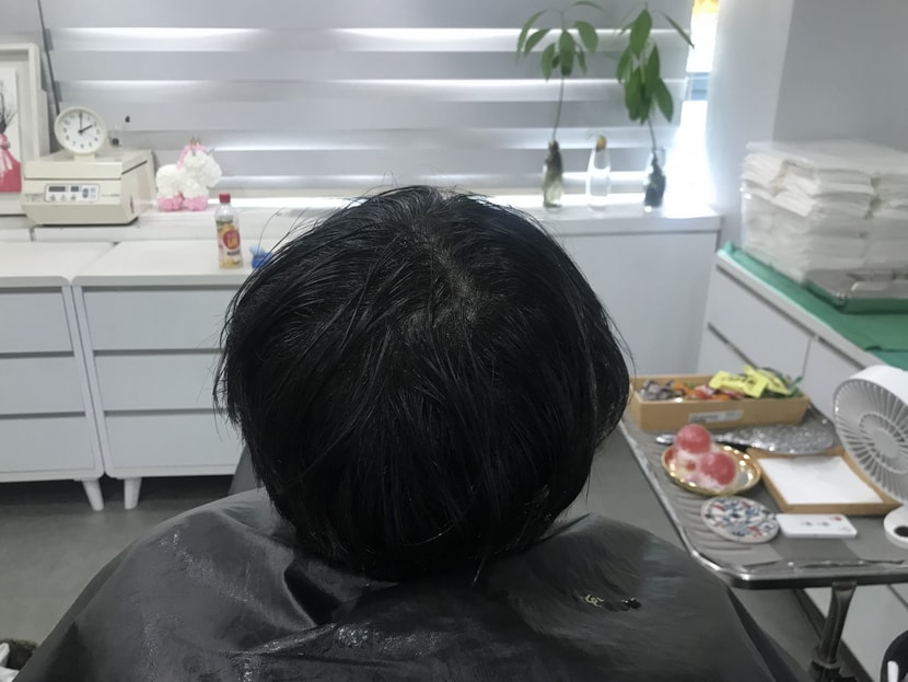 리터치 전 1