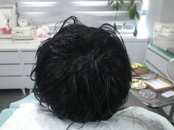 리터치 후 1