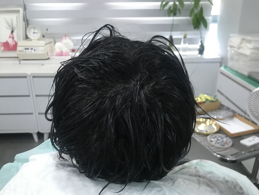 리터치 후 1