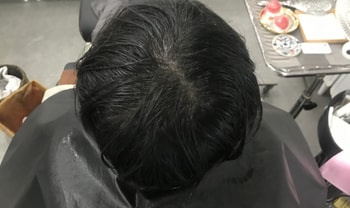 리터치 전 2