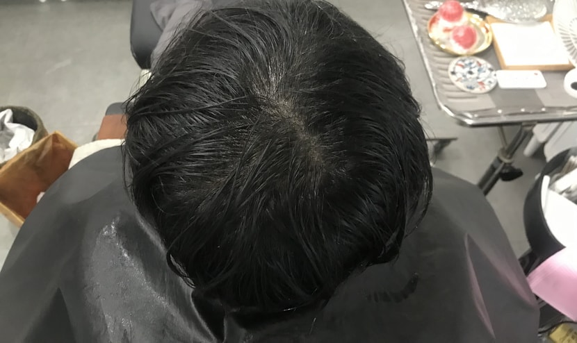 리터치 전 2