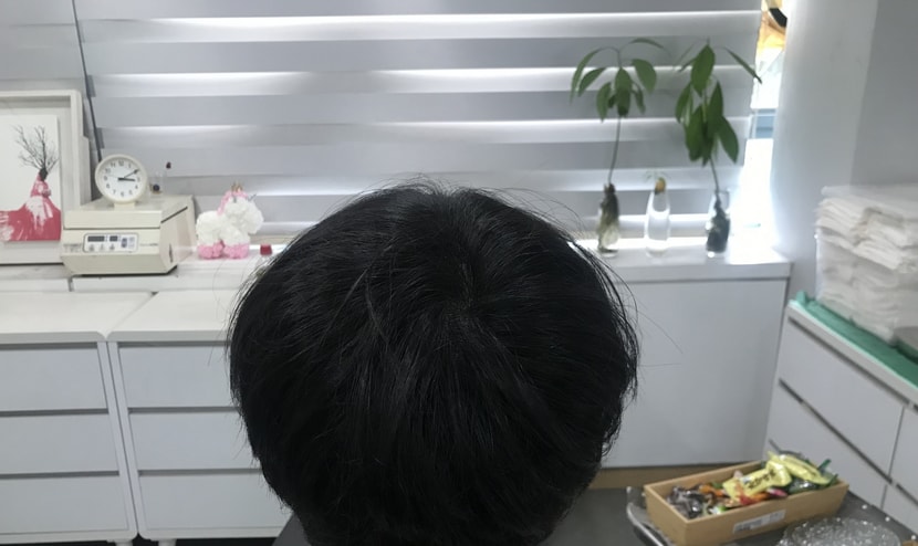 리터치 후 2