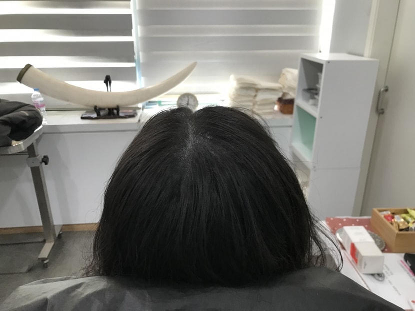 리터치 후