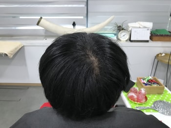 21년