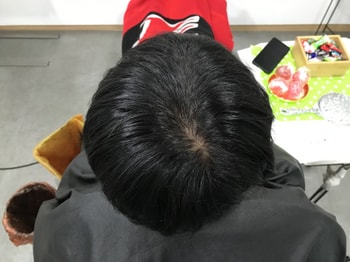 21년