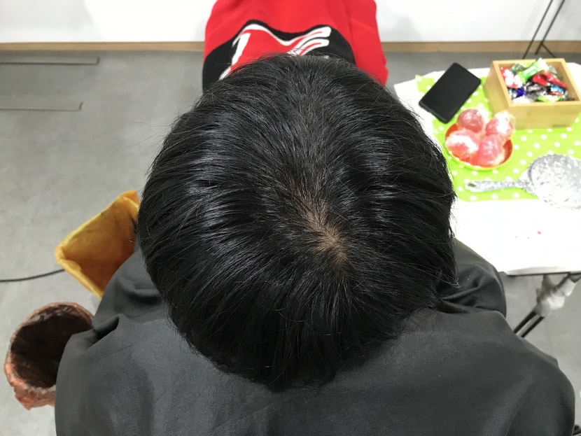 21년